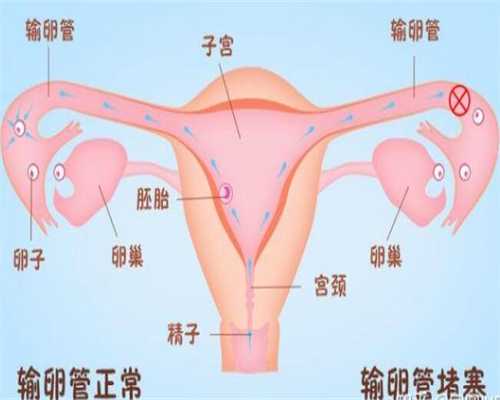 代孕官方网站,北京助孕机构生男孩包成功多少钱